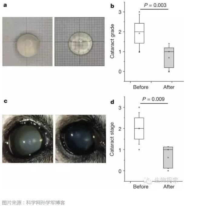 Nature重大突破：白内障治疗或告别手术时代，用眼药水即可